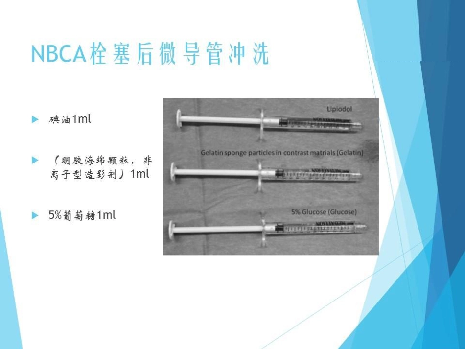 NBCA胶在急诊出血介入治疗中的应用_第11页