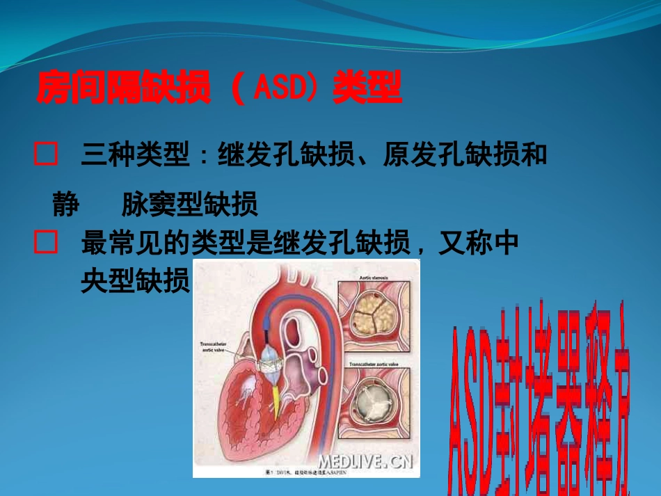 不常用心脏介入治疗_第10页