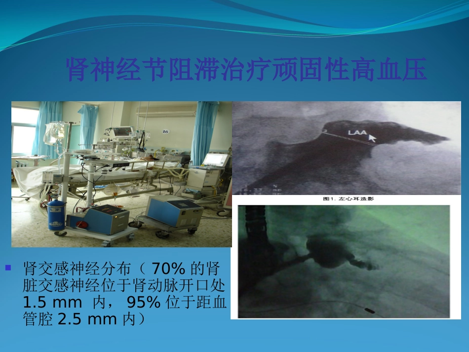 不常用心脏介入治疗_第4页