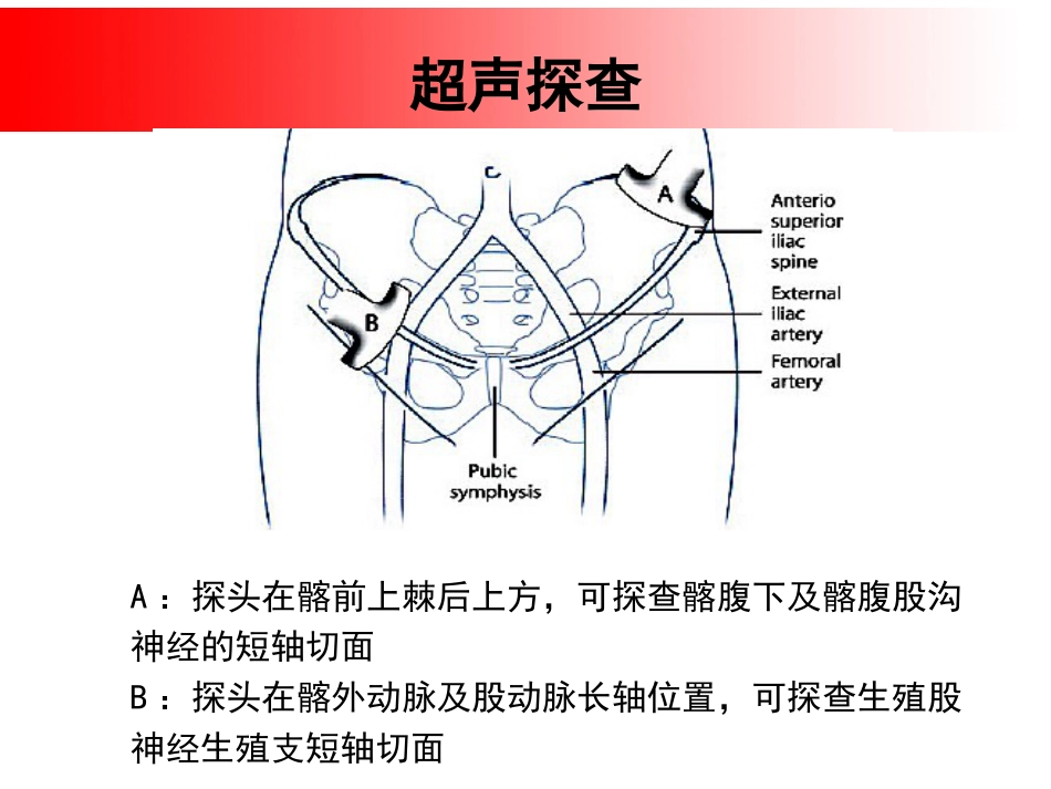 超声引导下盆腔疼痛的介入治疗_第13页