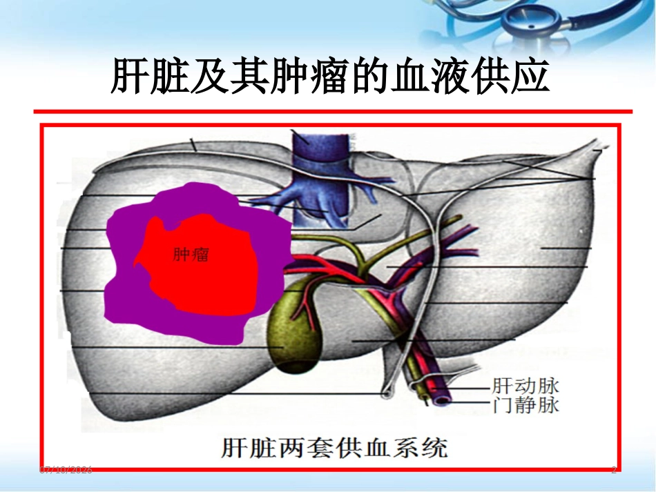 肝癌的放射治疗ppt参考课件_第2页
