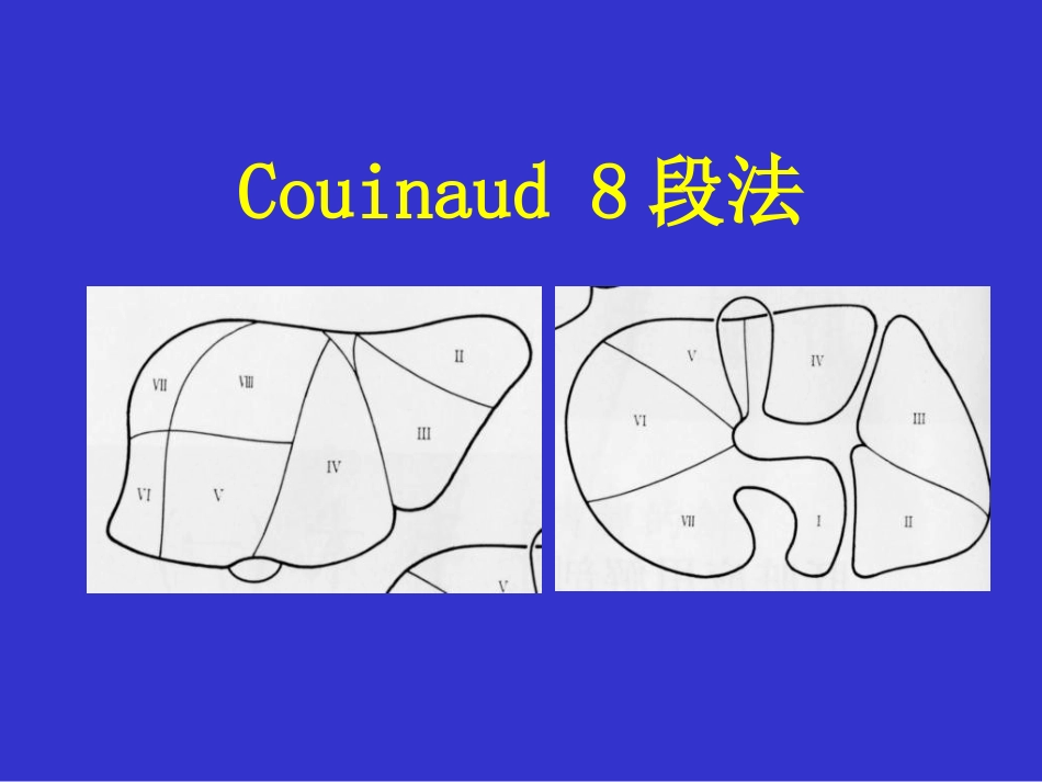 肝癌的外科治疗ppt课件_第6页