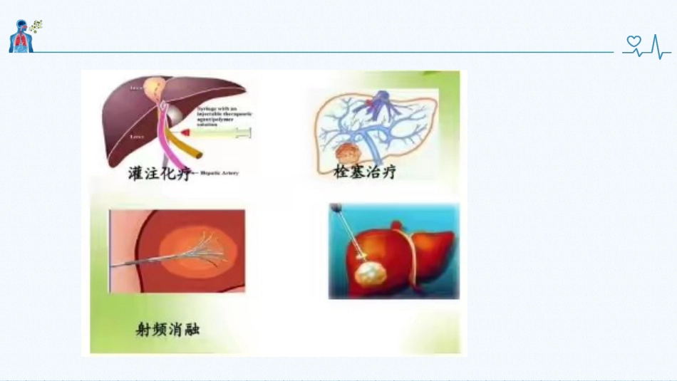 肝癌健康教育_第13页
