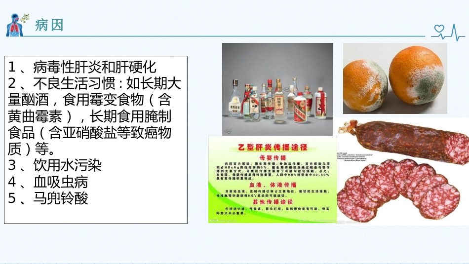 肝癌健康教育_第3页