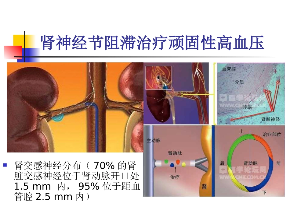 不常用的心脏介入治疗_第4页
