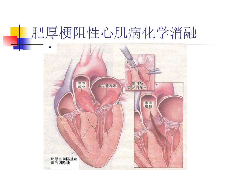 不常用的心脏介入治疗_第6页