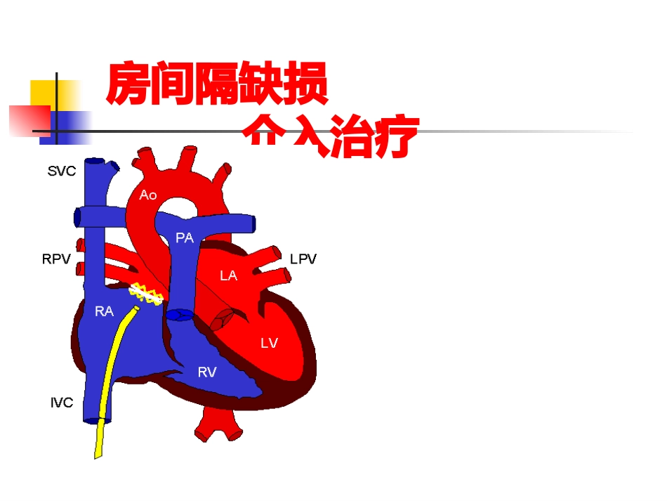 不常用的心脏介入治疗_第9页
