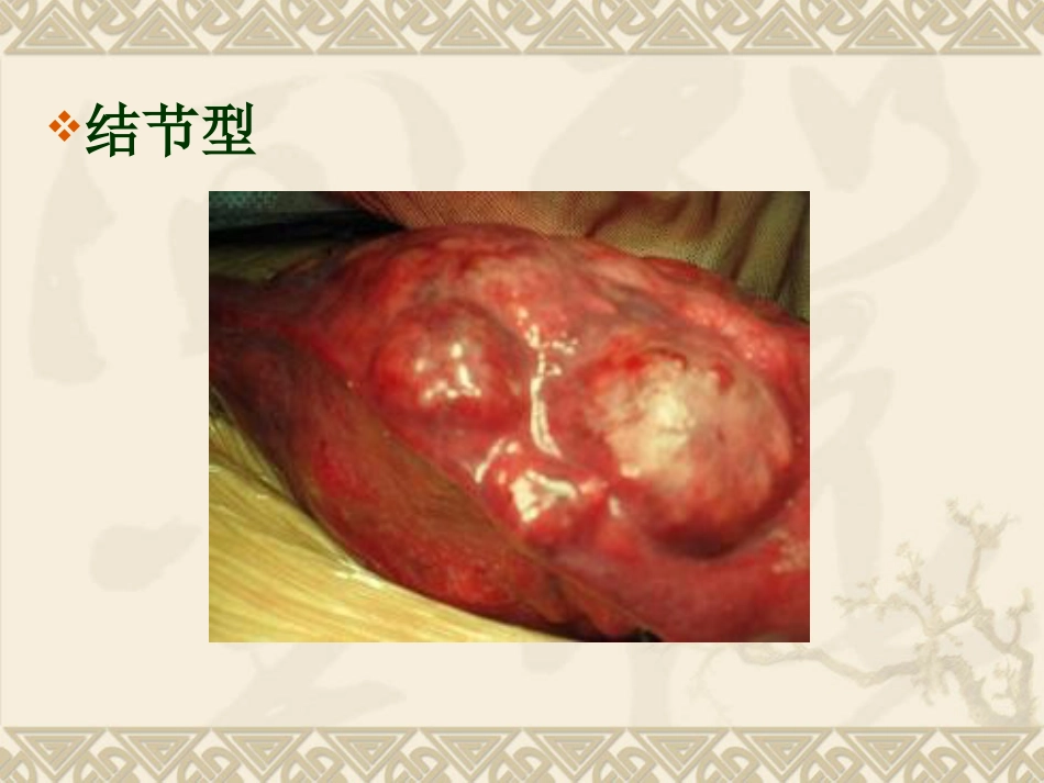 肝癌ppt_第12页