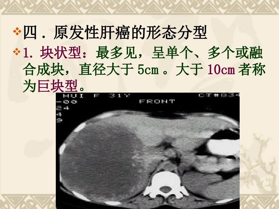 肝癌ppt_第9页