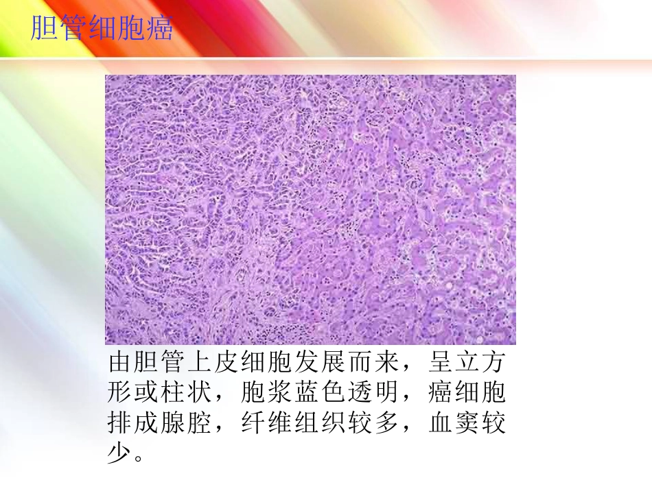 肝癌简介_第13页