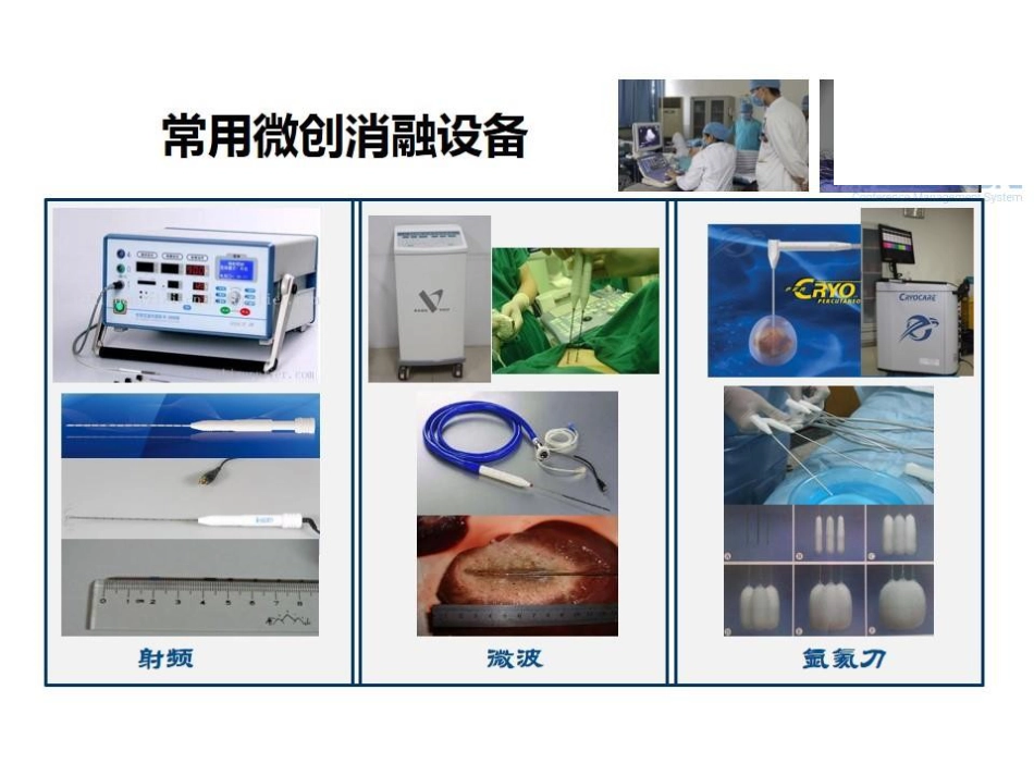 肝癌的几种消融治疗方法的比较_第4页