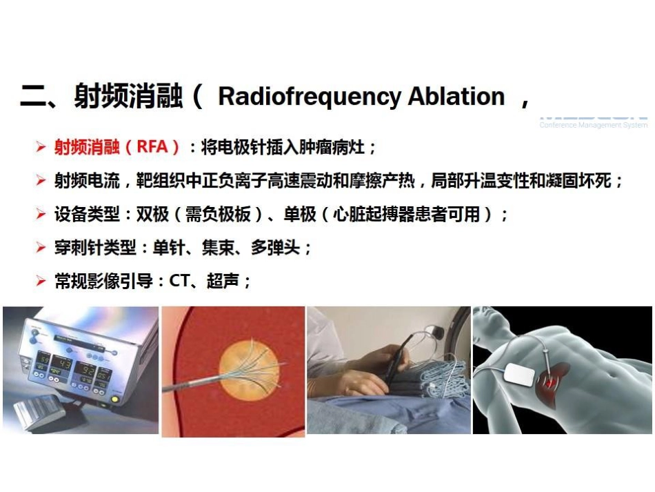 肝癌的几种消融治疗方法的比较_第8页