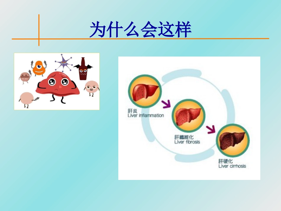 肝癌防治,从日常生活做起_第4页
