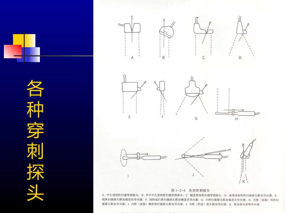 超声介入-US_第10页