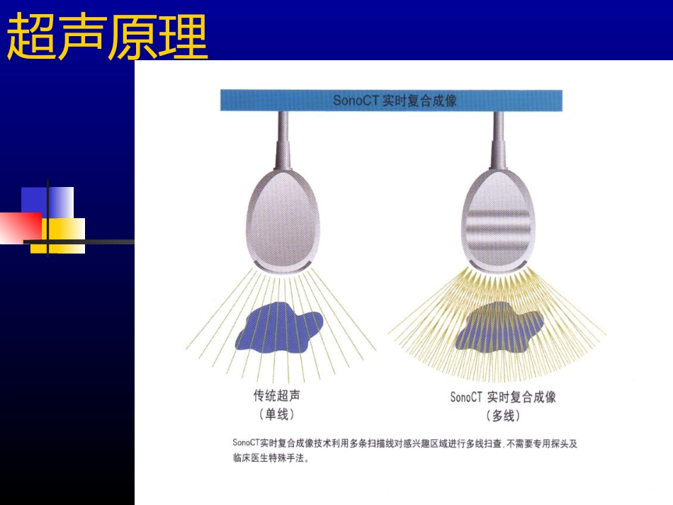 超声介入-US_第4页
