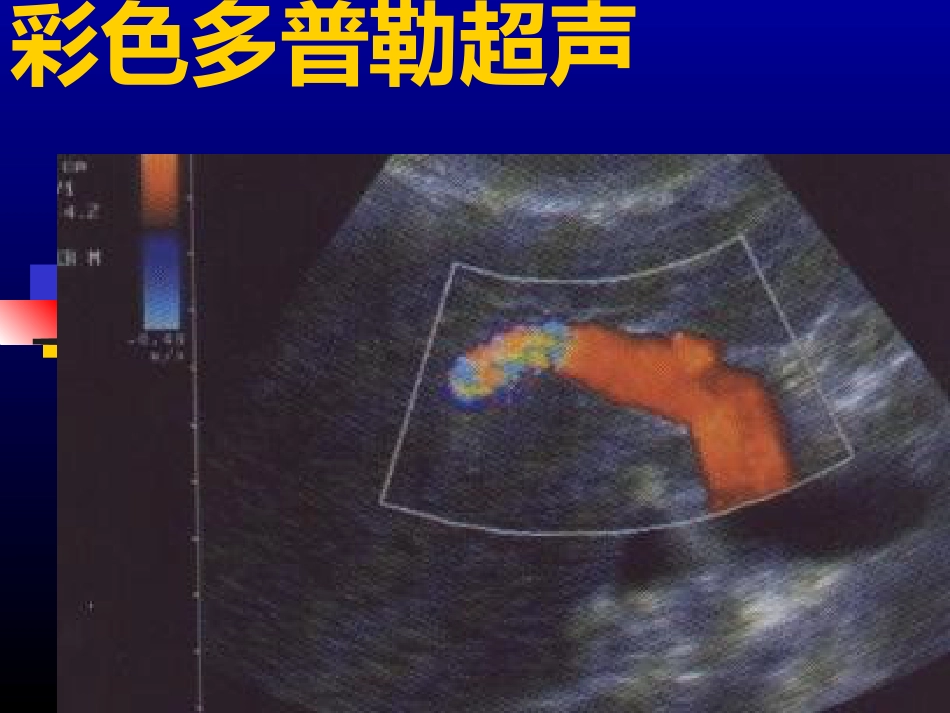 超声介入-US_第5页