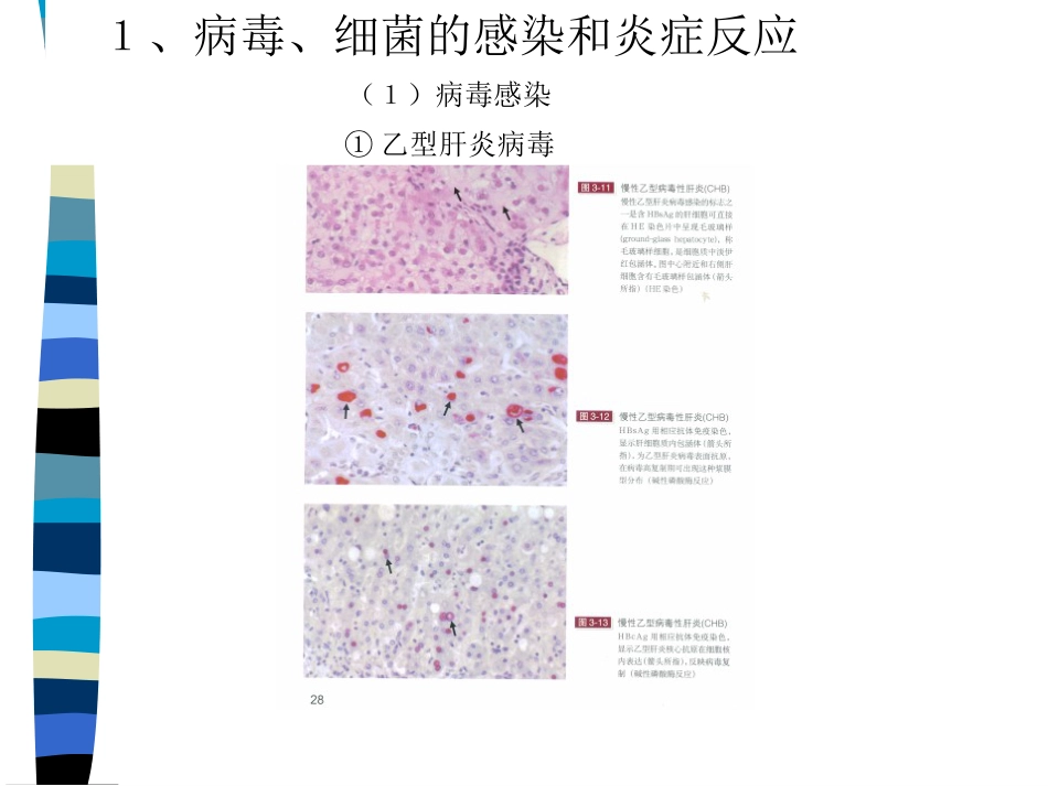 肝癌与肝炎关系_第11页