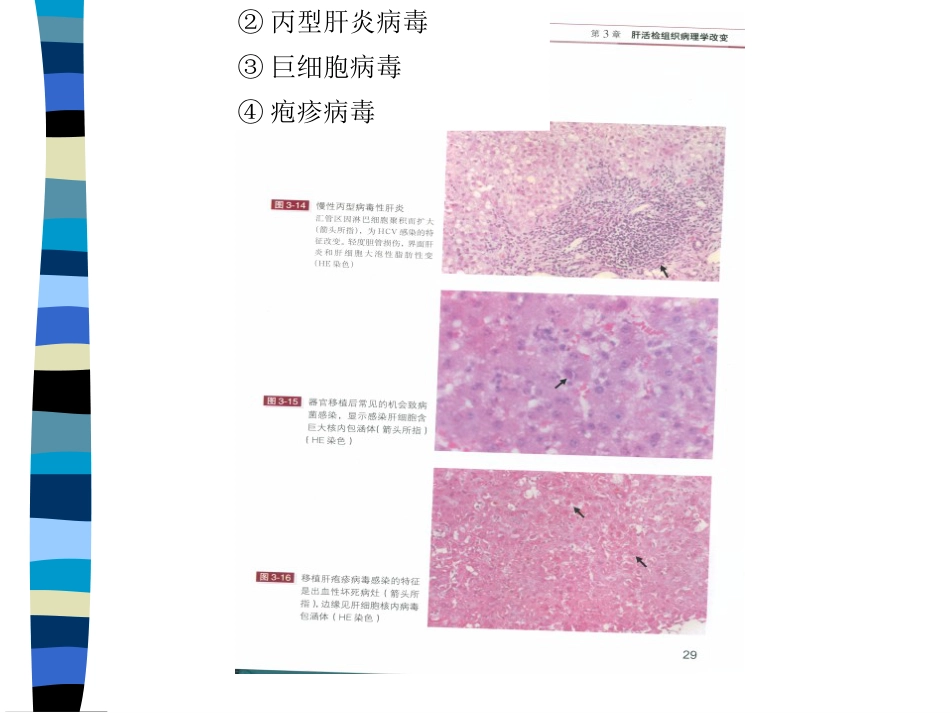 肝癌与肝炎关系_第12页