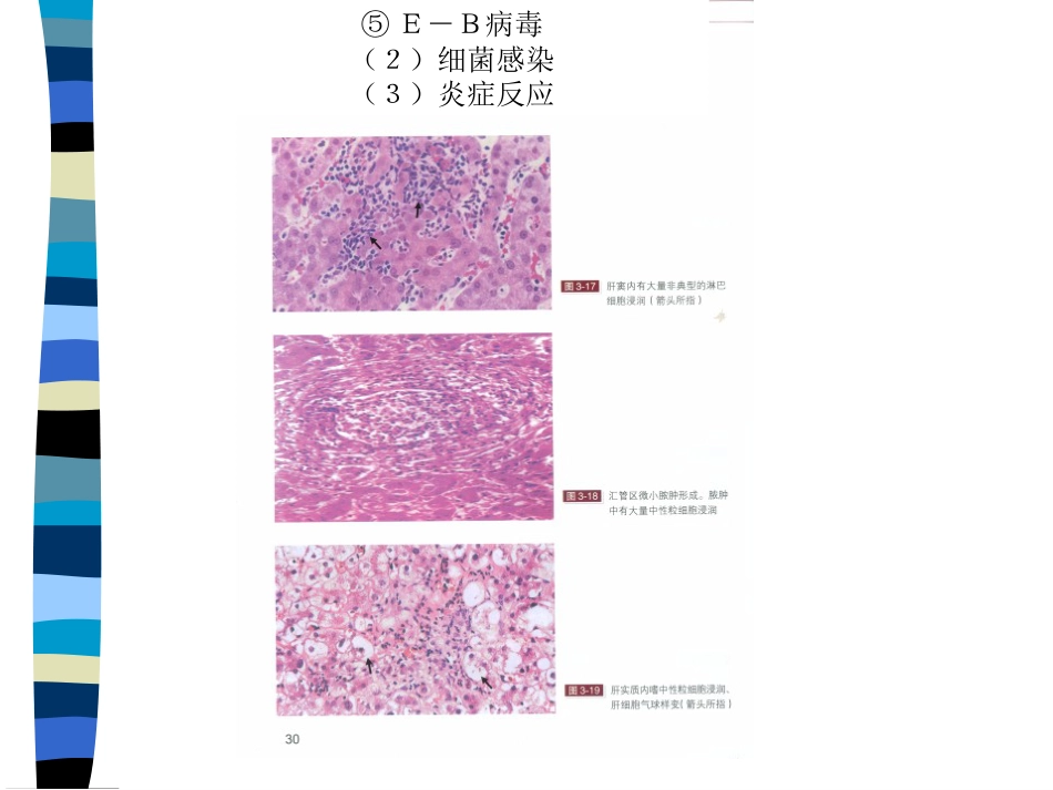 肝癌与肝炎关系_第13页