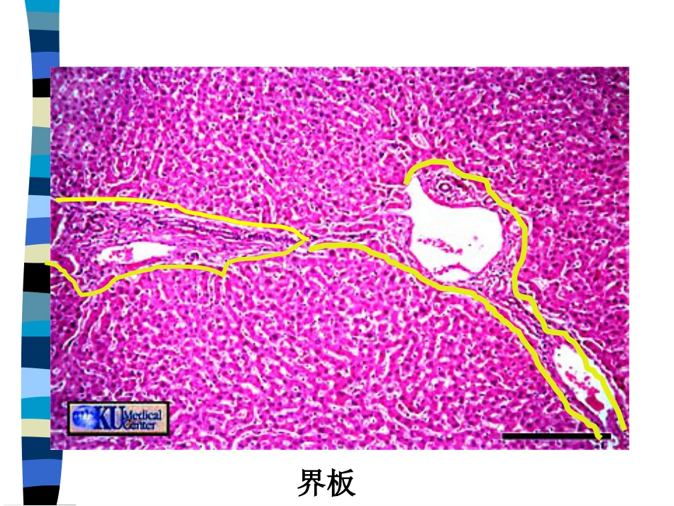 肝癌与肝炎关系_第9页