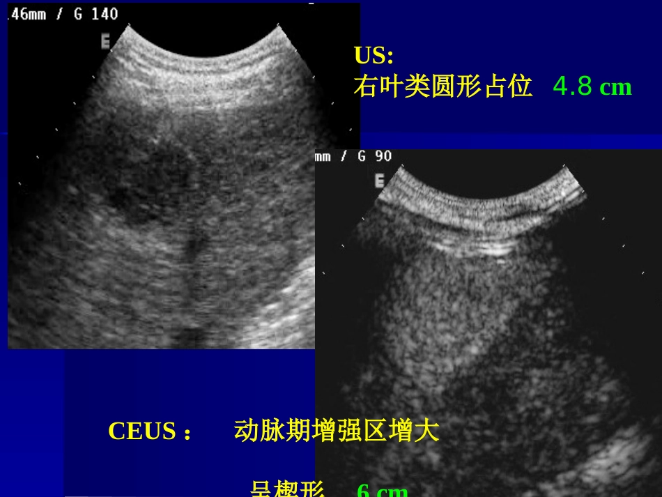 肝癌策略及疗效_第10页