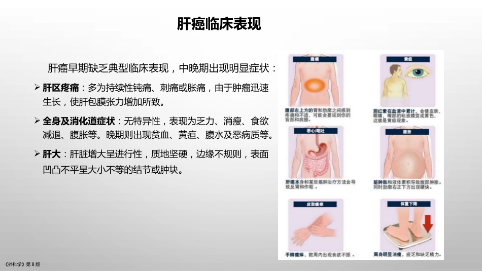 肝癌疾病基础知识_第6页