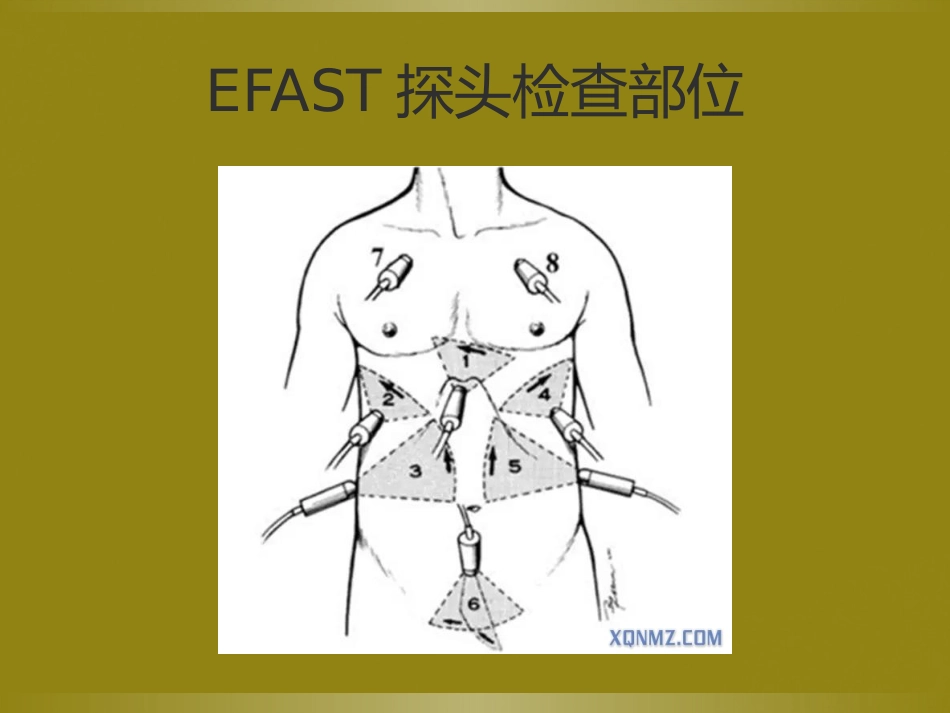 床旁超声FAST介入超声_第4页