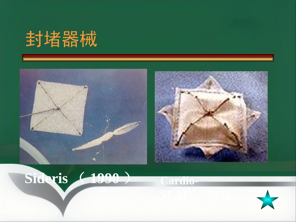 房间隔缺损介入治疗_第11页