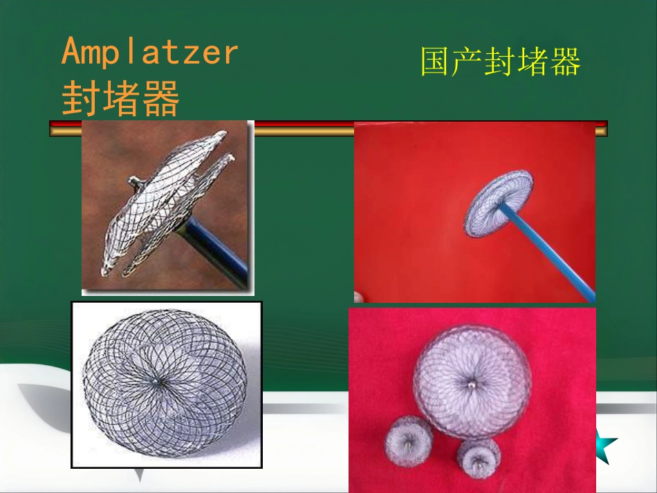 房间隔缺损介入治疗_第15页