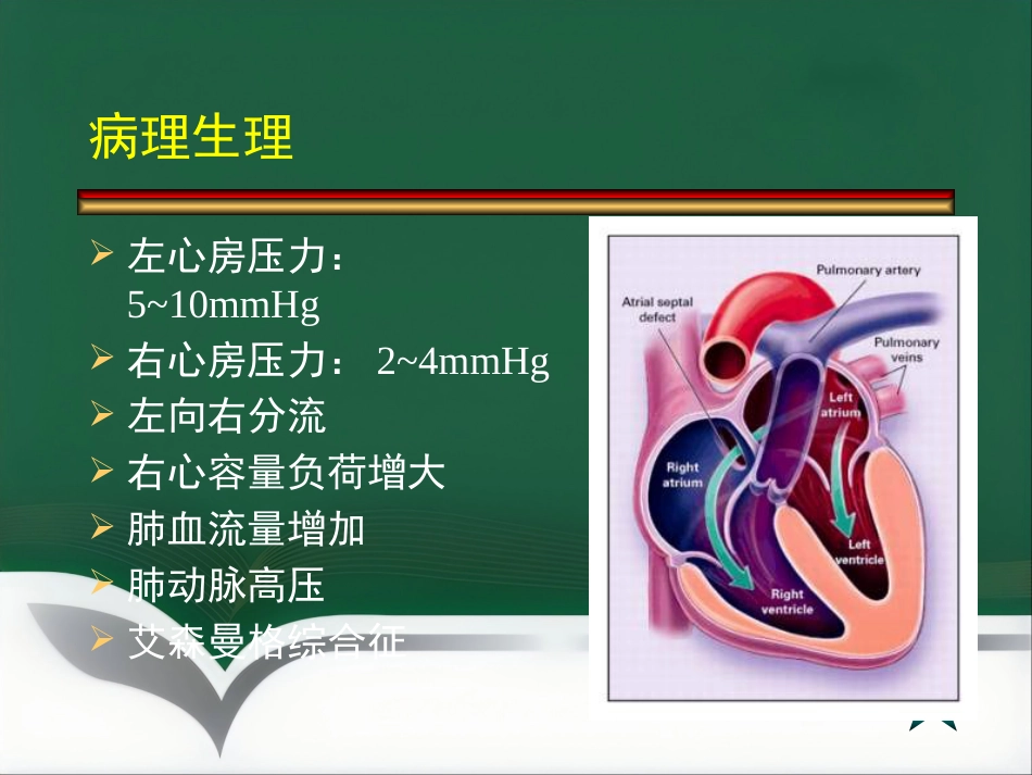 房间隔缺损介入治疗_第3页
