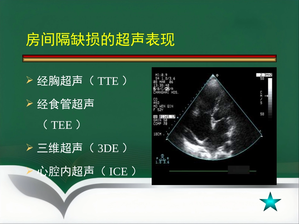 房间隔缺损介入治疗_第4页
