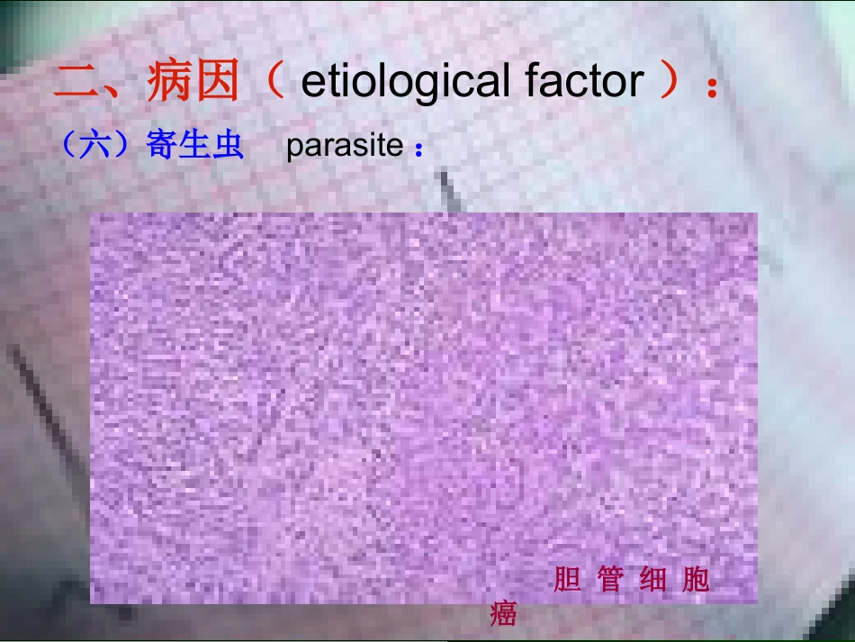 肝癌的诊断与综合治疗_第13页