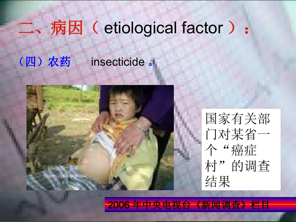 肝癌的诊断与综合治疗_第9页