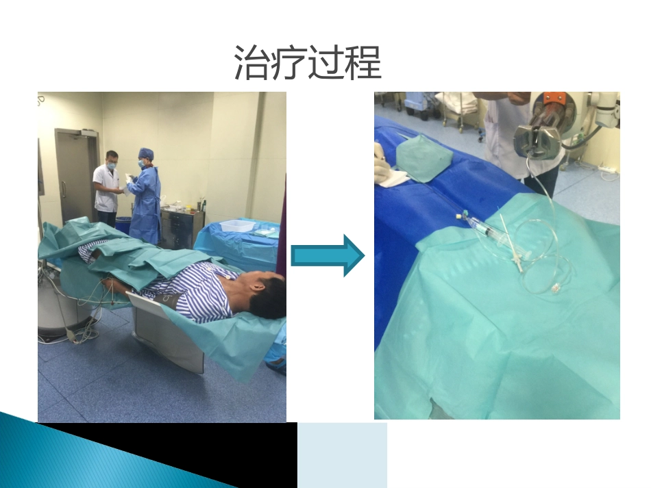 肝癌TACE护理ppt_第12页