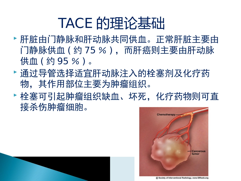 肝癌TACE护理ppt_第6页