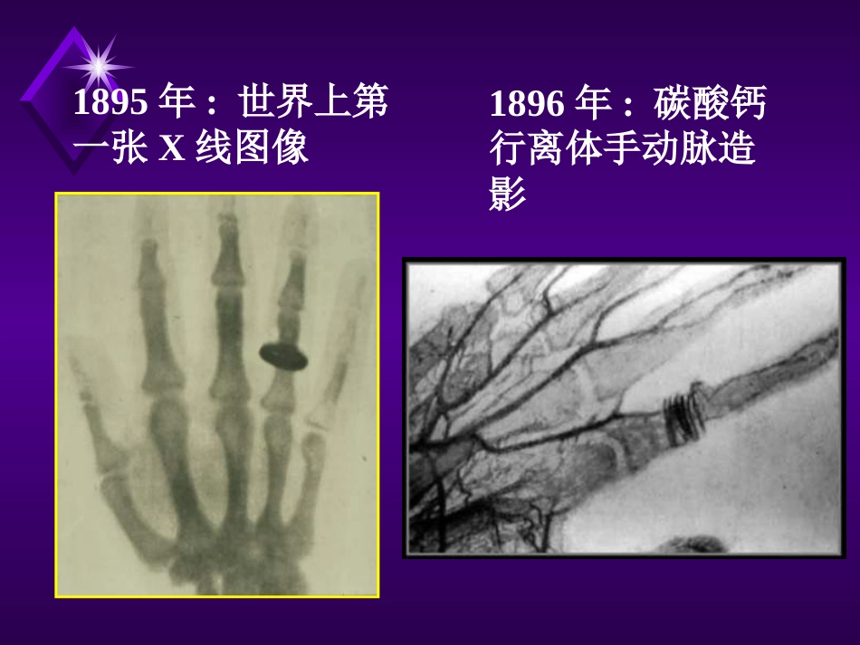 对比剂在介入诊疗中的应用_第5页