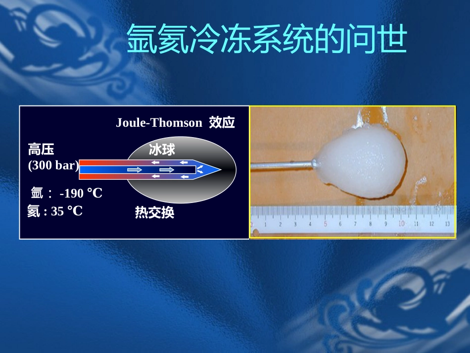 肝癌的氩氦刀消融治疗_第11页