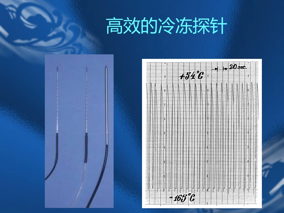 肝癌的氩氦刀消融治疗_第12页