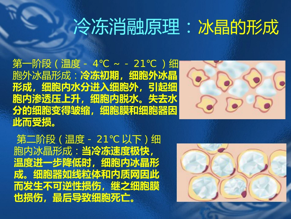肝癌的氩氦刀消融治疗_第13页