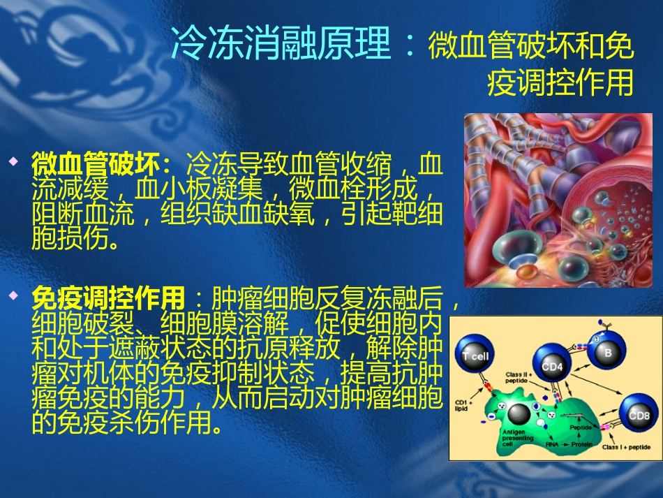肝癌的氩氦刀消融治疗_第14页