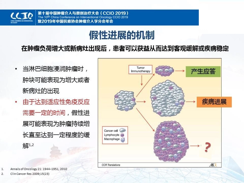 肝癌免疫治疗的假性进展探索_第15页