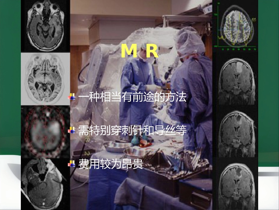 非血管性介入放射学_第10页