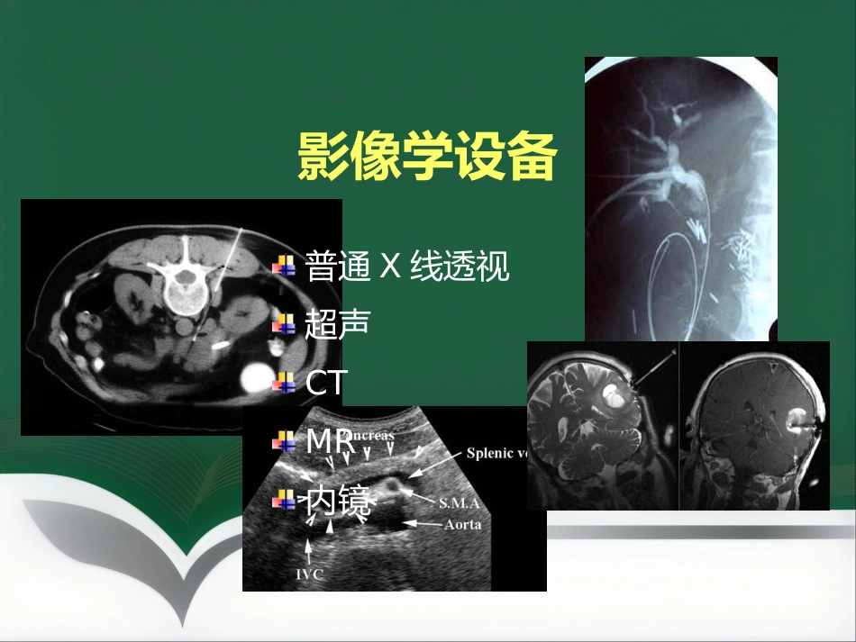 非血管性介入放射学_第5页
