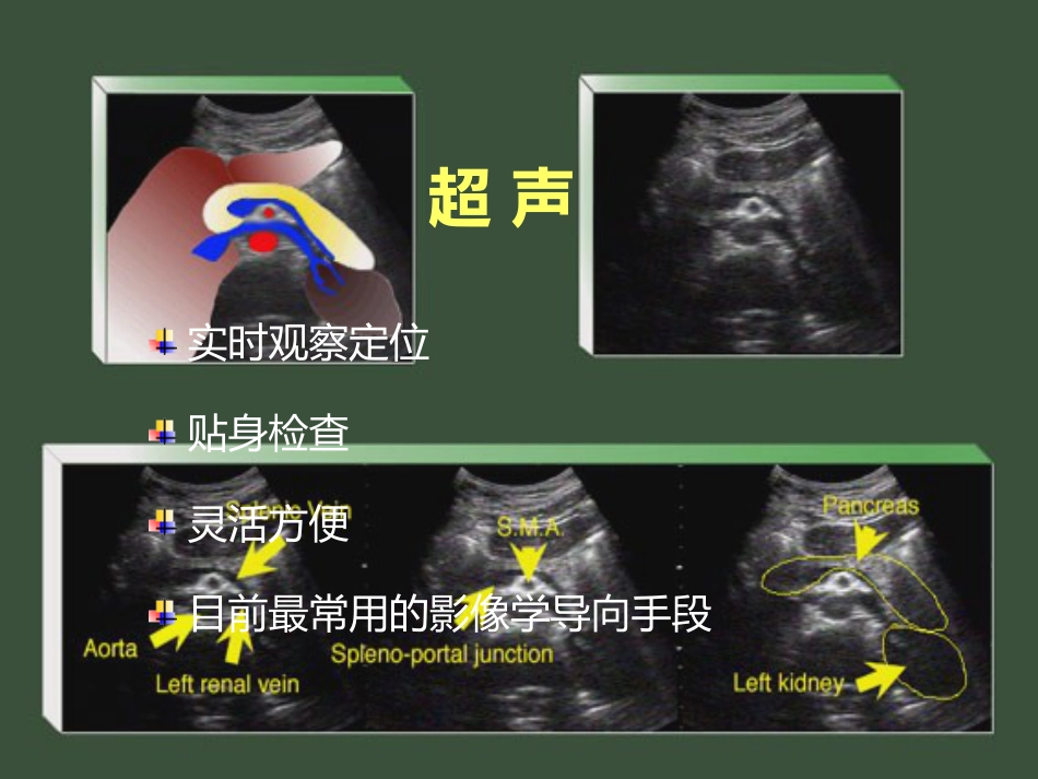 非血管性介入放射学_第6页