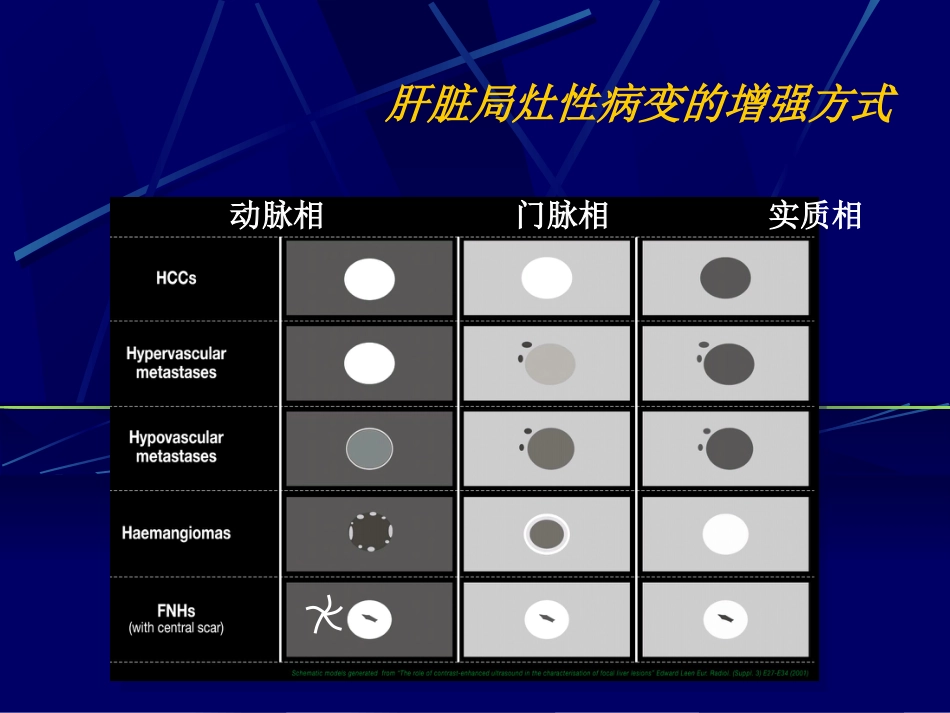 肝癌超声造影(1)_第3页
