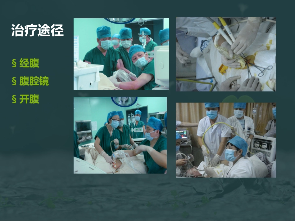 肝癌微波消融 (2)_第12页