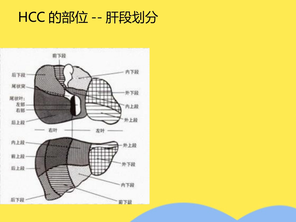 肝癌分期诊断(共53张PPT)_第9页