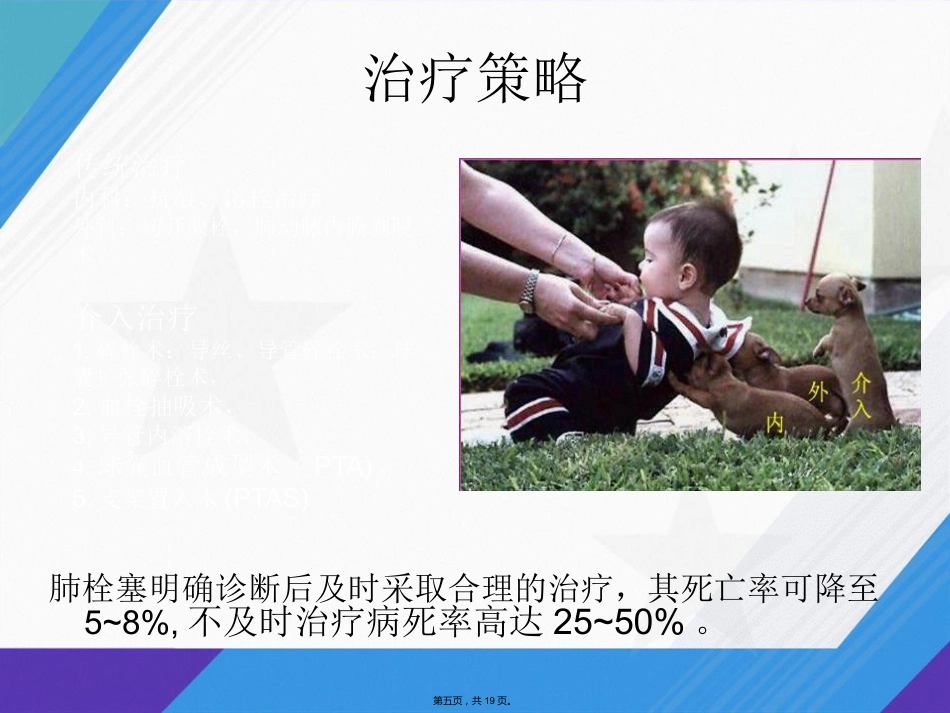 肺栓塞介入治疗讲课_第4页