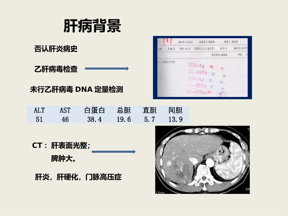 肝癌介入治疗PPT课件_第4页
