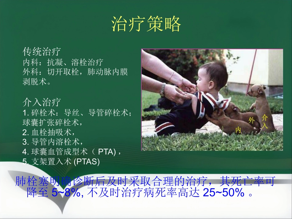肺栓塞 介入治疗讲解_第4页